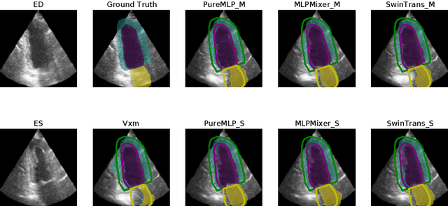 Figure 4 for Unsupervised Echocardiography Registration through Patch-based MLPs and Transformers