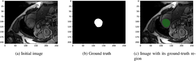 Figure 1 for High-Resolution Boundary Detection for Medical Image Segmentation with Piece-Wise Two-Sample T-Test Augmented Loss