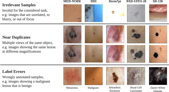 Figure 1 for Towards Reliable Dermatology Evaluation Benchmarks