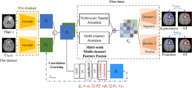 Figure 1 for Prediction of brain tumor recurrence location based on multi-modal fusion and nonlinear correlation learning