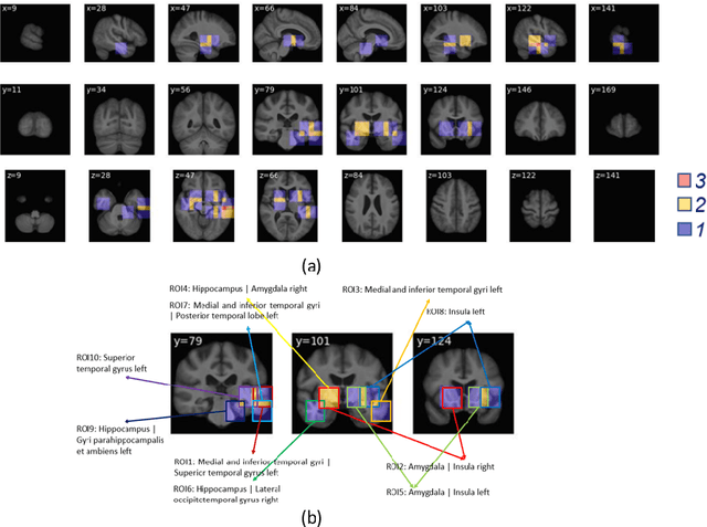 Figure 3 for An Interpretable Machine Learning Model with Deep Learning-based Imaging Biomarkers for Diagnosis of Alzheimer's Disease