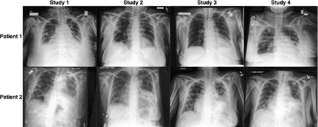 Figure 1 for X-ray Recognition: Patient identification from X-rays using a contrastive objective