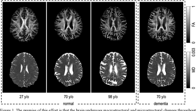 Figure 1 for Predicting Age from White Matter Diffusivity with Residual Learning