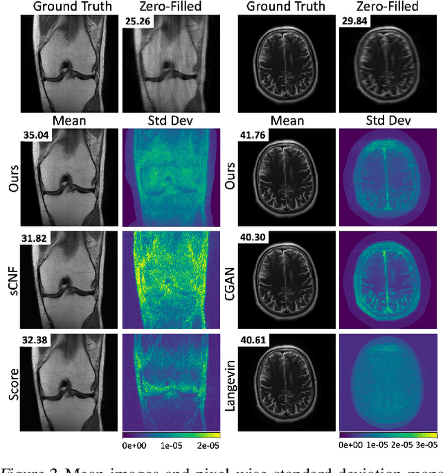 Figure 3 for A Conditional Normalizing Flow for Accelerated Multi-Coil MR Imaging