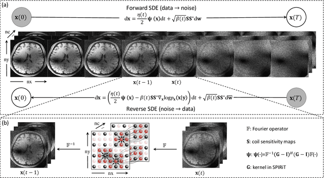 Figure 1 for SPIRiT-Diffusion: Self-Consistency Driven Diffusion Model for Accelerated MRI