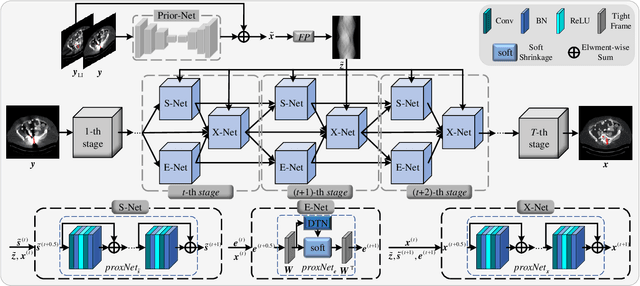 Figure 1 for TriDoNet: A Triple Domain Model-driven Network for CT Metal Artifact Reduction