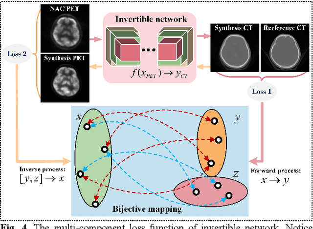Figure 4 for Synthetic CT Generation via Variant Invertible Network for All-digital Brain PET Attenuation Correction