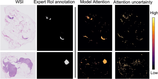 Figure 3 for Active Learning Enhances Classification of Histopathology Whole Slide Images with Attention-based Multiple Instance Learning