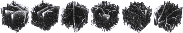 Figure 1 for Simulation-Based Segmentation of Blood Vessels in Cerebral 3D OCTA Images