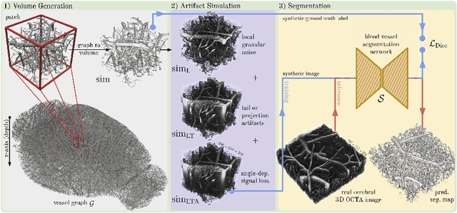 Figure 3 for Simulation-Based Segmentation of Blood Vessels in Cerebral 3D OCTA Images