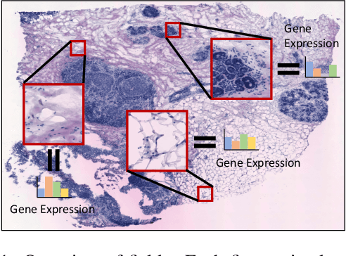 Figure 1 for Exemplar Guided Deep Neural Network for Spatial Transcriptomics Analysis of Gene Expression Prediction