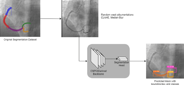 Figure 1 for Data Augmentation through Pseudolabels in Automatic Region Based Coronary Artery Segmentation for Disease Diagnosis