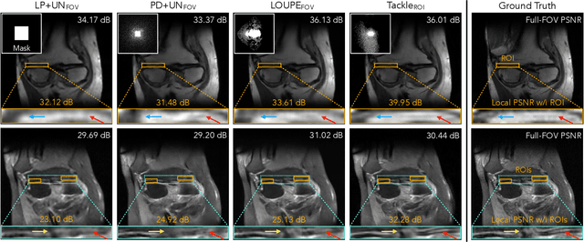 Figure 4 for Learning Task-Specific Strategies for Accelerated MRI