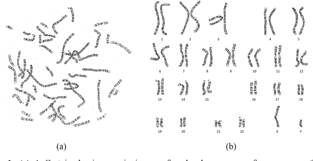 Figure 1 for Tokensome: Towards a Genetic Vision-Language GPT for Explainable and Cognitive Karyotyping