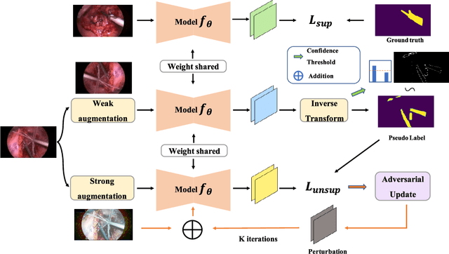 Figure 2 for SegMatch: A semi-supervised learning method for surgical instrument segmentation