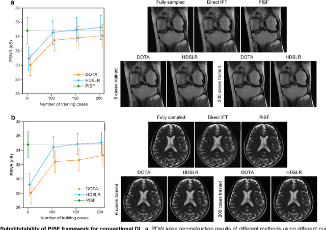 Figure 4 for One for Multiple: Physics-informed Synthetic Data Boosts Generalizable Deep Learning for Fast MRI Reconstruction