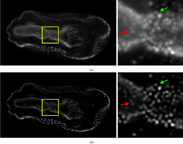 Figure 4 for Leveraging Classic Deconvolution and Feature Extraction in Zero-Shot Image Restoration