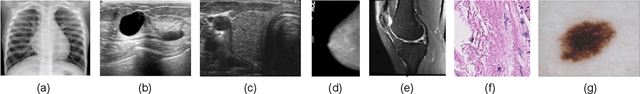Figure 3 for Revisiting Hidden Representations in Transfer Learning for Medical Imaging