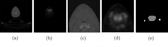 Figure 3 for Prompt-based Tuning of Transformer Models for Multi-Center Medical Image Segmentation