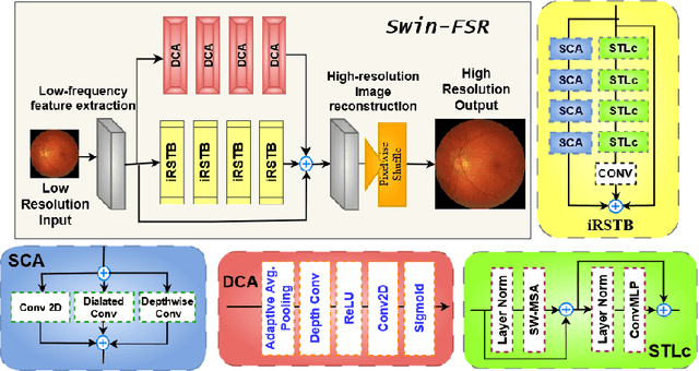 Figure 1 for Revolutionizing Space Health (Swin-FSR): Advancing Super-Resolution of Fundus Images for SANS Visual Assessment Technology