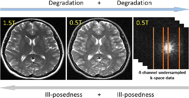 Figure 1 for Meta-Learning Enabled Score-Based Generative Model for 1.5T-Like Image Reconstruction from 0.5T MRI