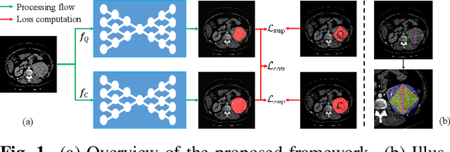 Figure 1 for RECIST Weakly Supervised Lesion Segmentation via Label-Space Co-Training