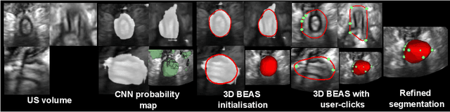 Figure 1 for DEEPBEAS3D: Deep Learning and B-Spline Explicit Active Surfaces