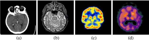 Figure 1 for AdaFuse: Adaptive Medical Image Fusion Based on Spatial-Frequential Cross Attention