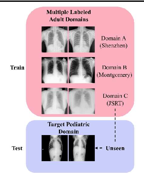 Figure 1 for Generalizability of Deep Adult Lung Segmentation Models to the Pediatric Population: A Retrospective Study