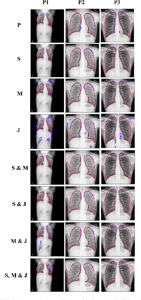 Figure 4 for Generalizability of Deep Adult Lung Segmentation Models to the Pediatric Population: A Retrospective Study