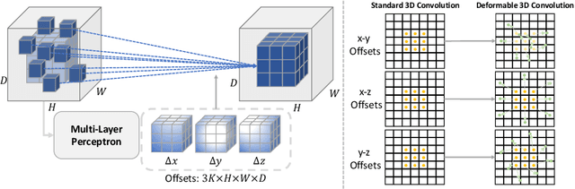Figure 3 for DeformUX-Net: Exploring a 3D Foundation Backbone for Medical Image Segmentation with Depthwise Deformable Convolution