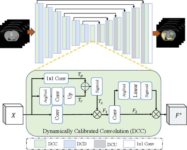 Figure 1 for Dynamic U-Net: Adaptively Calibrate Features for Abdominal Multi-organ Segmentation
