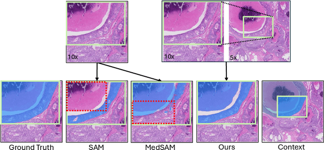 Figure 1 for WSI-SAM: Multi-resolution Segment Anything Model (SAM) for histopathology whole-slide images