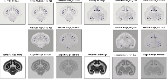 Figure 3 for Implicit neural representations for joint decomposition and registration of gene expression images in the marmoset brain