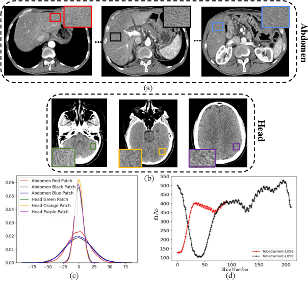 Figure 1 for Robust Cross-domain CT Image Reconstruction via Bayesian Noise Uncertainty Alignment