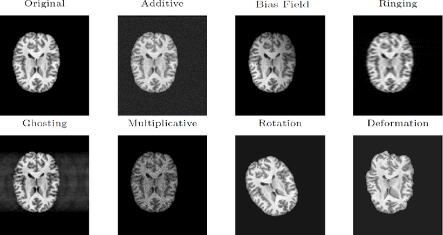 Figure 1 for Data Augmentation-Based Unsupervised Domain Adaptation In Medical Imaging