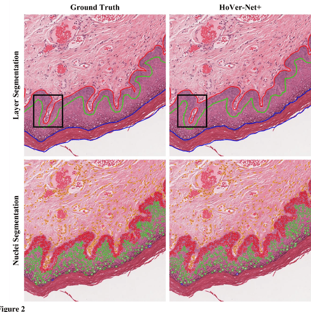 Figure 3 for A Fully Automated and Explainable Algorithm for the Prediction of Malignant Transformation in Oral Epithelial Dysplasia
