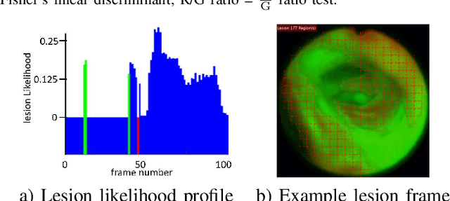 Figure 3 for Autofluorescence Bronchoscopy Video Analysis for Lesion Frame Detection