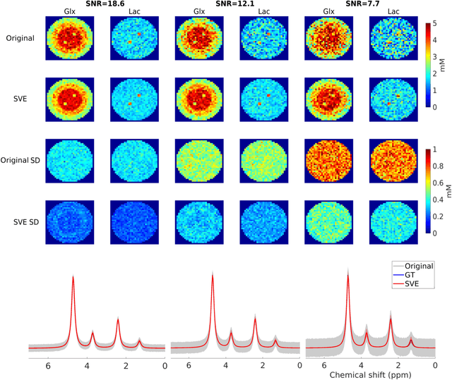 Figure 4 for Preserved Edge Convolutional Neural Network for Sensitivity Enhancement of Deuterium Metabolic Imaging (DMI)
