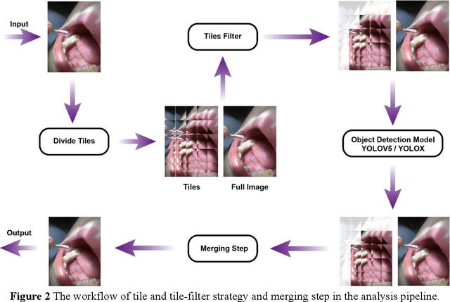 Figure 3 for Object Detection for Caries or Pit and Fissure Sealing Requirement in Children's First Permanent Molars