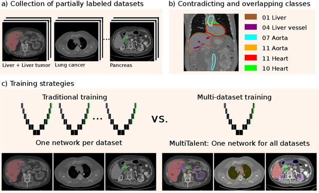Figure 1 for MultiTalent: A Multi-Dataset Approach to Medical Image Segmentation