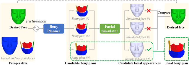 Figure 1 for Soft-tissue Driven Craniomaxillofacial Surgical Planning