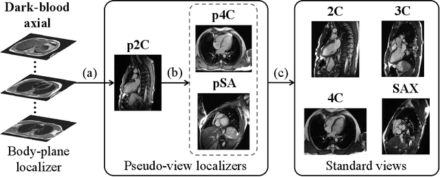 Figure 3 for Automatic view plane prescription for cardiac magnetic resonance imaging via supervision by spatial relationship between views