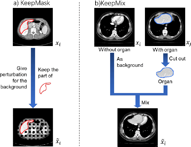 Figure 1 for Mixing Data Augmentation with Preserving Foreground Regions in Medical Image Segmentation