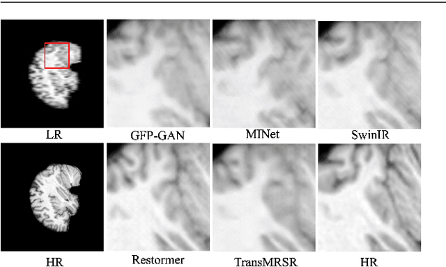 Figure 1 for TransMRSR: Transformer-based Self-Distilled Generative Prior for Brain MRI Super-Resolution