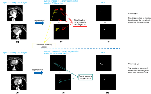 Figure 1 for TransCC: Transformer Network for Coronary Artery CCTA Segmentation