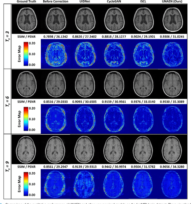 Figure 3 for UNAEN: Unsupervised Abnomality Extraction Network for MRI Motion Artifact Reduction