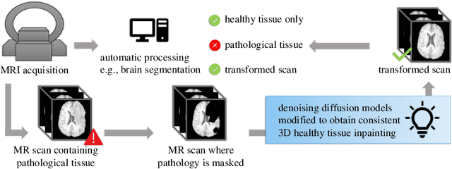 Figure 1 for Denoising Diffusion Models for 3D Healthy Brain Tissue Inpainting