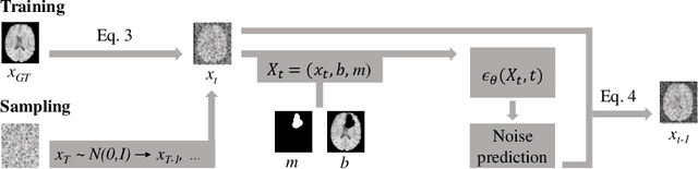 Figure 3 for Denoising Diffusion Models for 3D Healthy Brain Tissue Inpainting