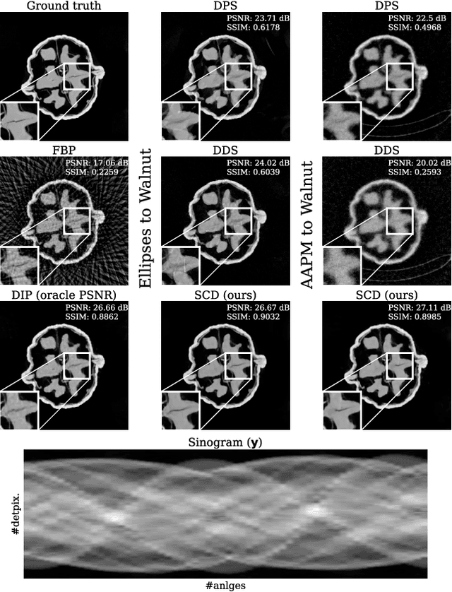 Figure 1 for Steerable Conditional Diffusion for Out-of-Distribution Adaptation in Imaging Inverse Problems